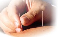 Acupuncture Centre in Southampton 724261 Image 2
